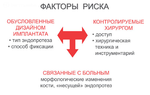Перипротезный перелом факторы риска Перипротезный перелом факторы риска